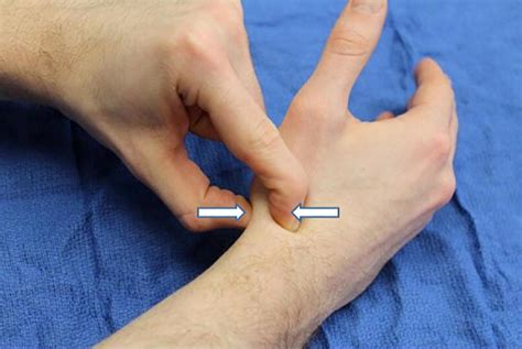 scaphoid compression axial load test|scaphoid fracture analysis.